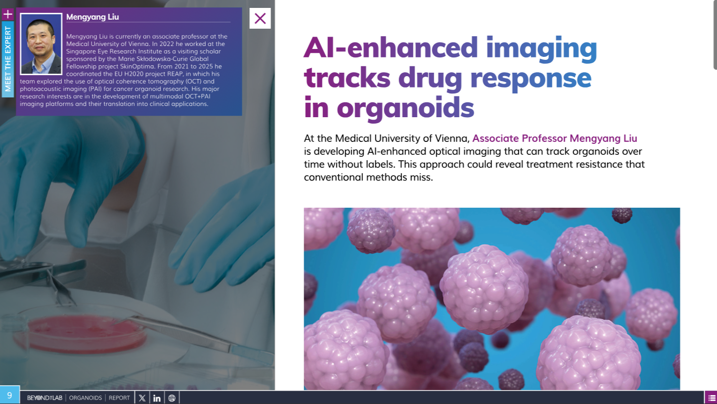 Drug Target Review interview with Mengyang Liu on AI-enhanced imaging and organoids